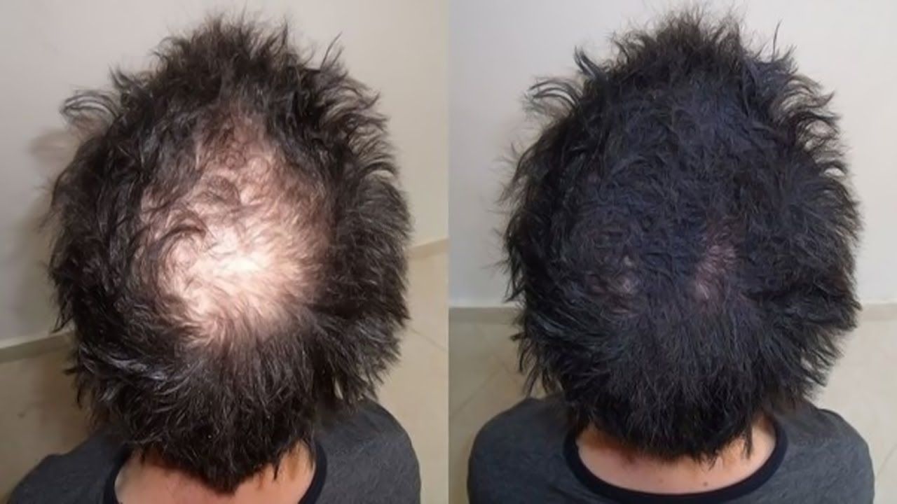 How to Effecitvely Cover Gray Hair in Men Over 40: 10 Natural Methods that Really Work